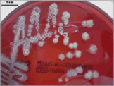 Pseudomonas_stutzeri_ZoBell.gif